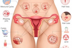 Ginekologs - sieviešu veselības uzraugs Republikas laukuma klīnika